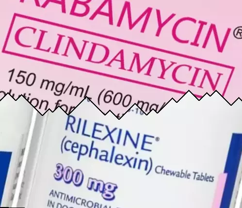 Clindamicina contra Cefalexina